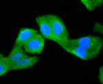 NUR77 Antibody in Immunocytochemistry (ICC/IF)