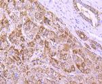 NUR77 Antibody in Immunohistochemistry (Paraffin) (IHC (P))