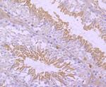 NUR77 Antibody in Immunohistochemistry (Paraffin) (IHC (P))