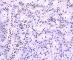 MRE11 Antibody in Immunohistochemistry (Paraffin) (IHC (P))