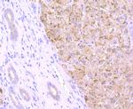 Cathepsin B Antibody in Immunohistochemistry (Paraffin) (IHC (P))