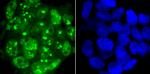 53BP1 Antibody in Immunocytochemistry (ICC/IF)