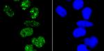 53BP1 Antibody in Immunocytochemistry (ICC/IF)