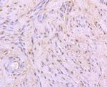 53BP1 Antibody in Immunohistochemistry (Paraffin) (IHC (P))