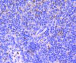 53BP1 Antibody in Immunohistochemistry (Paraffin) (IHC (P))