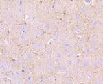 MUC2 Antibody in Immunohistochemistry (Paraffin) (IHC (P))