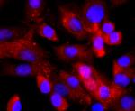 NFATC2 Antibody in Immunocytochemistry (ICC/IF)