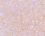 PRKAR2B Antibody in Immunohistochemistry (Paraffin) (IHC (P))