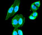 ChAT Antibody in Immunocytochemistry (ICC/IF)