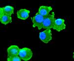 ChAT Antibody in Immunocytochemistry (ICC/IF)