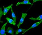 ChAT Antibody in Immunocytochemistry (ICC/IF)