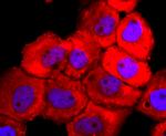 Tyrosinase Antibody in Immunocytochemistry (ICC/IF)