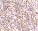 Tyrosinase Antibody in Immunohistochemistry (Paraffin) (IHC (P))