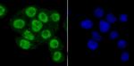 PRMT1 Antibody in Immunocytochemistry (ICC/IF)