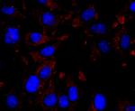 CXCL10 (IP-10) Antibody in Immunocytochemistry (ICC/IF)