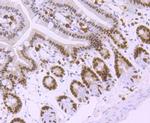 MSH6 Antibody in Immunohistochemistry (Paraffin) (IHC (P))