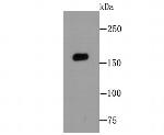 MSH6 Antibody in Western Blot (WB)