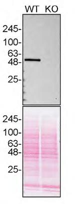 CaMKII delta Antibody in Western Blot (WB)