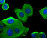 G6PD Antibody in Immunocytochemistry (ICC/IF)