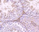 G6PD Antibody in Immunohistochemistry (Paraffin) (IHC (P))