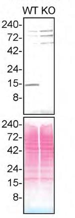 Profilin 1 Antibody in Western Blot (WB)