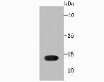 Profilin 1 Antibody in Western Blot (WB)