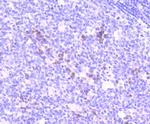 NFATC1 Antibody in Immunohistochemistry (Paraffin) (IHC (P))