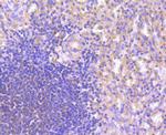 NFATC1 Antibody in Immunohistochemistry (Paraffin) (IHC (P))