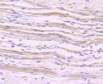 NFATC1 Antibody in Immunohistochemistry (Paraffin) (IHC (P))