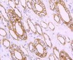 MRP2 Antibody in Immunohistochemistry (Paraffin) (IHC (P))