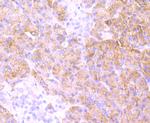 MRP2 Antibody in Immunohistochemistry (Paraffin) (IHC (P))