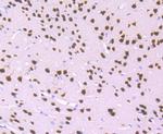 MEF2A Antibody in Immunohistochemistry (Paraffin) (IHC (P))