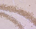 MEF2A Antibody in Immunohistochemistry (Paraffin) (IHC (P))