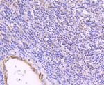 ULK1 Antibody in Immunohistochemistry (Paraffin) (IHC (P))