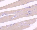 ULK1 Antibody in Immunohistochemistry (Paraffin) (IHC (P))