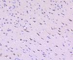 ULK1 Antibody in Immunohistochemistry (Paraffin) (IHC (P))