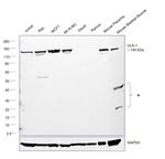 ULK1 Antibody in Western Blot (WB)