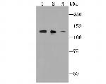 ULK1 Antibody in Western Blot (WB)