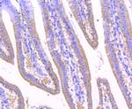 GOLPH2 Antibody in Immunohistochemistry (Paraffin) (IHC (P))