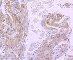 PDK1 Antibody in Immunohistochemistry (Paraffin) (IHC (P))