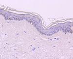 CDT1 Antibody in Immunohistochemistry (Paraffin) (IHC (P))