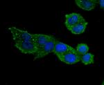 MMP9 Antibody in Immunocytochemistry (ICC/IF)