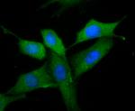 MMP9 Antibody in Immunocytochemistry (ICC/IF)