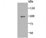 MMP9 Antibody in Western Blot (WB)