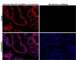 CD39 Antibody in Immunohistochemistry (Paraffin) (IHC (P))