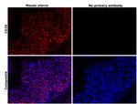 CD39 Antibody in Immunohistochemistry (Paraffin) (IHC (P))