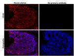 CD39 Antibody in Immunohistochemistry (Paraffin) (IHC (P))