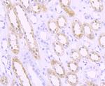 SPHK1 Antibody in Immunohistochemistry (Paraffin) (IHC (P))