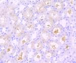 SPHK1 Antibody in Immunohistochemistry (Paraffin) (IHC (P))