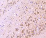 IP3 Receptor 1 Antibody in Immunohistochemistry (Paraffin) (IHC (P))